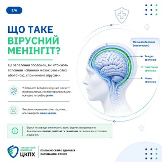 Вірусний менінгіт: причини, симптоми, лікування та профілактика